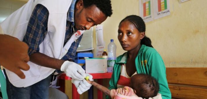 Un miembro de Médicos Sin Fronteras (MSF) atendiendo a un niño con desnutrición en el centro de estabilización en el hospital de Gedeb, en Gedeo, al sur de Etiopía. 
Markus Boening/MSF