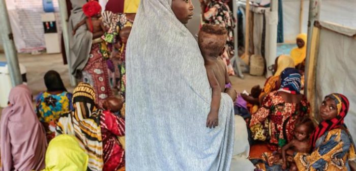 Imagen de archivo del 29 de junio de 2022: una madre lleva a su hijo para ser atendido en nuestro centro ambulatorio de alimentación terapeútica. Katsina, Nigeria.George Osodi.