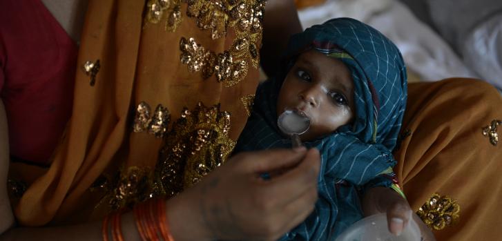 Niña con desnutrición aguda severa en Birha © Alfons Rodriguez/MSF