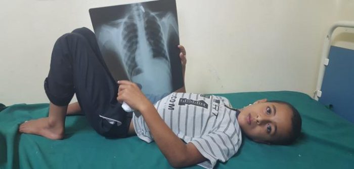 Ibrahim (12 años) con una placa de rayos x que muestra dónde quedó alojada la bala que le dispararon cuando salía de la mezquita.  ©Crystal VanLeeuwen/MSF