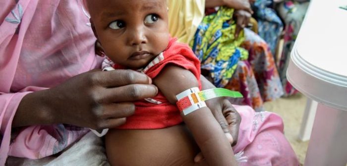 Ese simple instrumeto (MUAC) permite identificar rápidamente, al medir la circunferencia del brazo de los niños, el nivel de gravedad de la desnutrición. Actividades de Médicos Sin Fronteras en Gwange, Maiduguri, Nigeria ©Aurelie Baumel/MSF