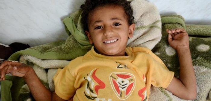 Ishaq fue herido en la pierna por "dos hombres jugando con armas"  y se recuperó en la clínica pediátrica de Médicos Sin Fronteras en Taiz, Yemen. ©Malak Shaher/MSF