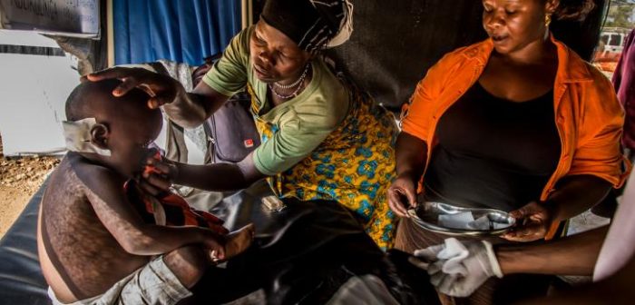 Uno de nuestros pacientes en el Centro médico en el campo de refugiados Bidi Bidi, Uganda.