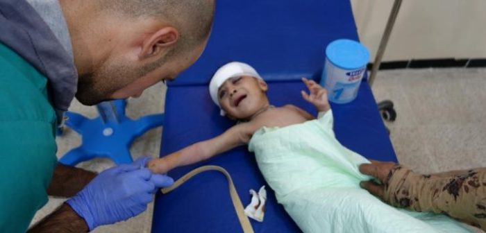 El personal del hospital atiende a una bebé que llegó con metralla en la frente. ©Jacob Kuehn/MSF
