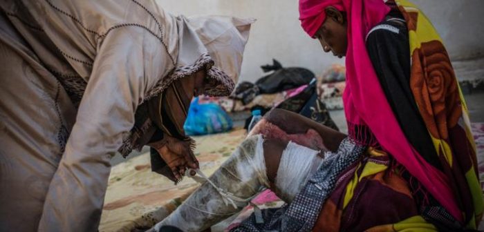 "La mujer del pañuelo rosa" en el centro de detención para mujeres en Sorman, al oeste de Tripoli, en Libia; en la foto está siendo atendida por otra detenida. Ellas y muchos otros migrantes que están detenidos fueron interceptados en el mar por la guardia costera libia mientras intentaban huir de Libia para llegar a Europa. Las quemaduras en sus piernas fueron causadas por la mezcla de nafta y agua de mar. © Guillaume Binet/Myop