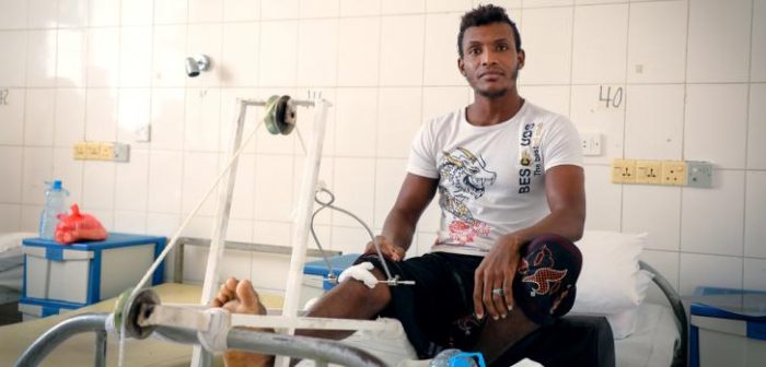 Un paciente en el hospital de MSF en Aden, Noviembre de 2017. MSF está recibiendo heridos de las líneas del frente en su hospital en Aden.
Ehab Zawati/MSF